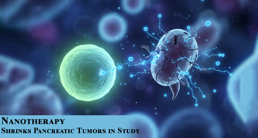 Nanotherapy Shrinks Pancreatic Tumors in Study