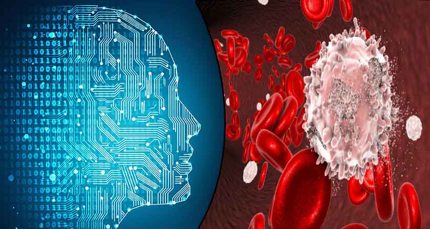 Artificial intelligence can detect common forms of blood cancer