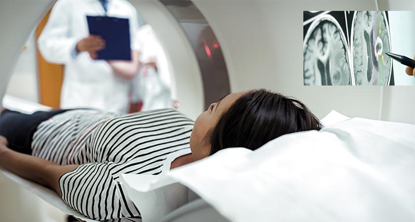 CT scans used in medical imaging may increase the risk of brain tumors