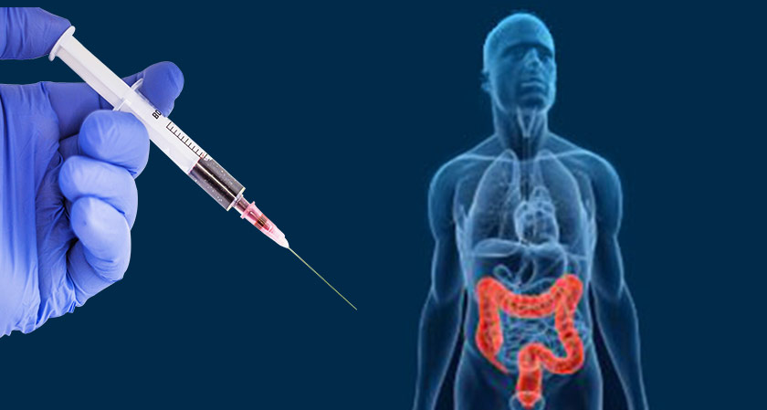 Injection That Makes Colorectal Cancer ‘Glow’ During Surgery