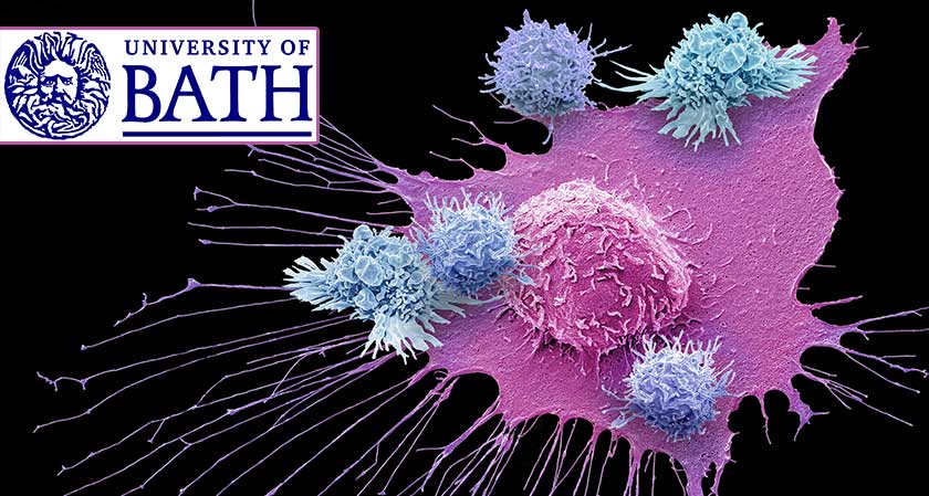 University of Bath: Cancer Researchers Discover Promising Prostate Cancer Drug Candidates by Using High-Throughput Screening