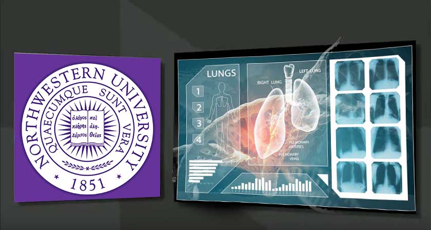 Researchers create a new AI System that Can Predict Lung Cancer Faster
