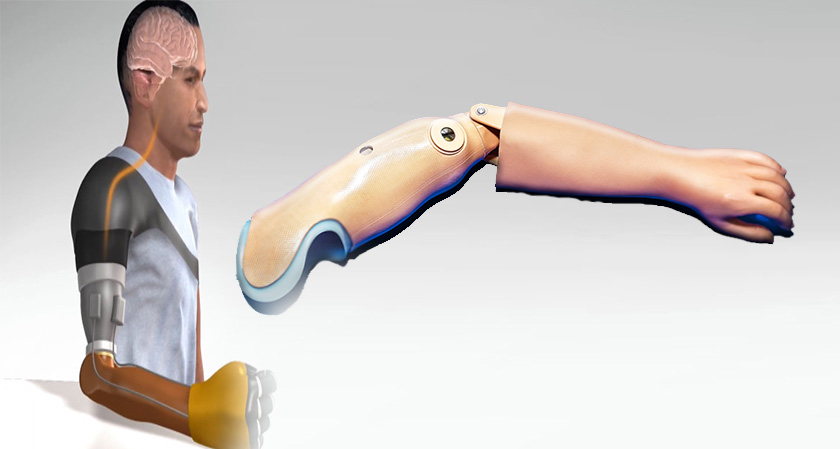 New prosthetic arm promises proprioceptive capabilities